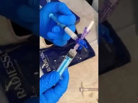 Biostimulator results video at Hollywood Clinic