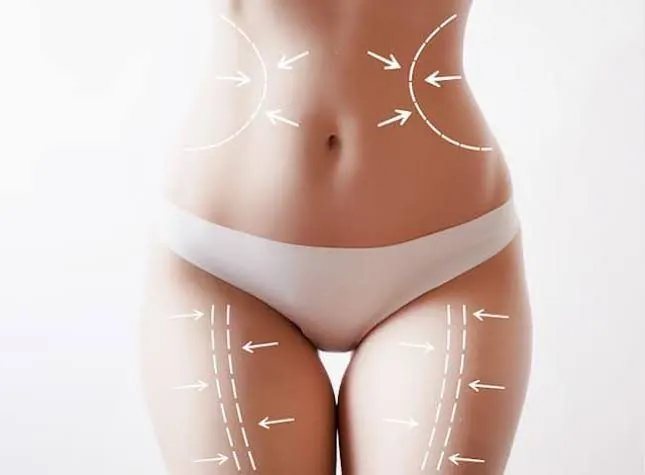 Body FX treatment areas — abdomen, flanks and thighs