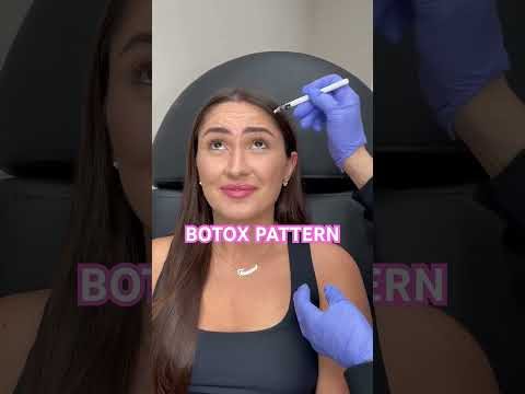 Botox marking pattern at Hollywood Clinic