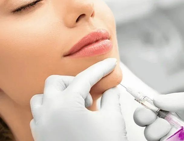 Lip filler injection for natural definition