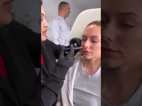 Dermal fillers treatment at Hollywood Clinic