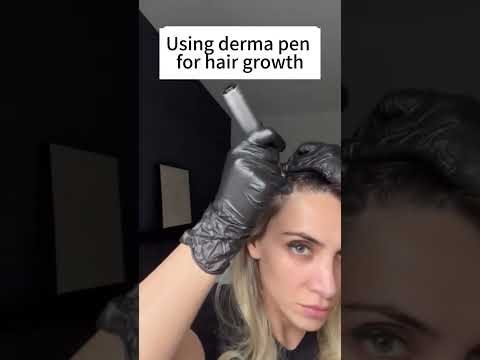 Derma pen for hair growth at Hollywood Clinic