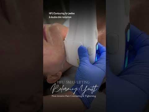HIFU jawline contouring at Hollywood Clinic