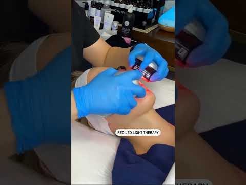 HydraFacial session at Hollywood Clinic