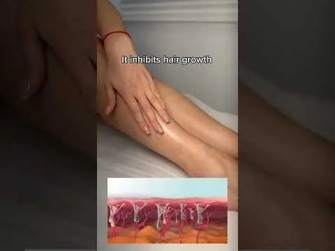 Laser hair removal session video at Hollywood Clinic