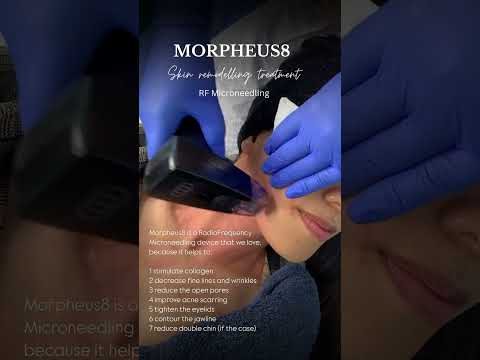 Skin tightening with Morpheus8 at Hollywood Clinic