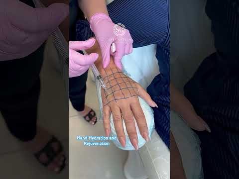 Hand hydration with skin boosters at Hollywood Clinic