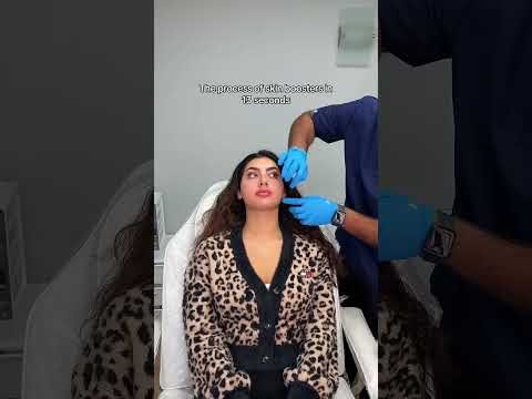 The process of skin boosters at Hollywood Clinic